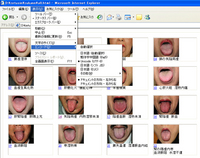 舌診の基礎CD-ROM